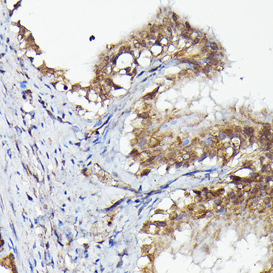 MKNK1 Rabbit polyclonal antibody