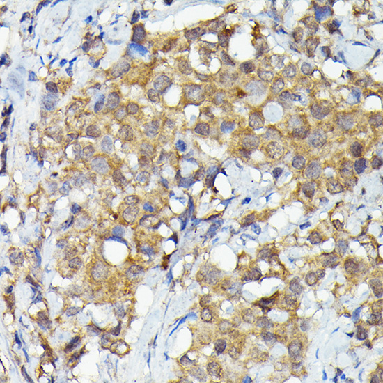 MKNK1 Rabbit polyclonal antibody