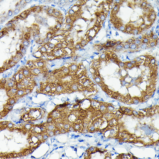 MKNK1 Rabbit polyclonal antibody