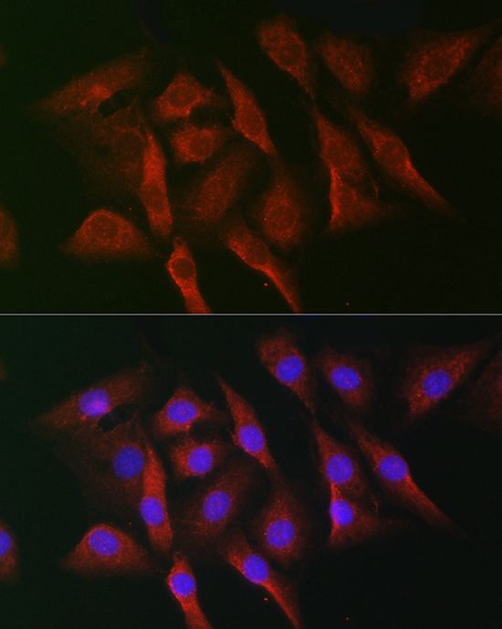 MKNK1 Rabbit polyclonal antibody