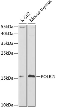 POLR2J Rabbit polyclonal antibody