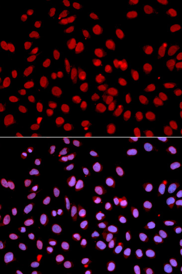 POLR2J Rabbit polyclonal antibody
