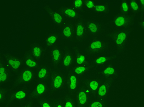 POLR2J Rabbit polyclonal antibody