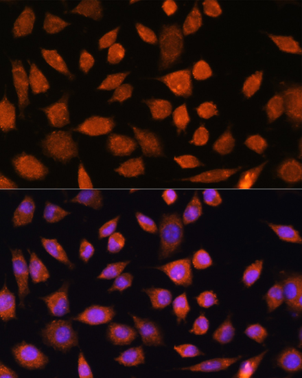 PLD3 Rabbit polyclonal antibody
