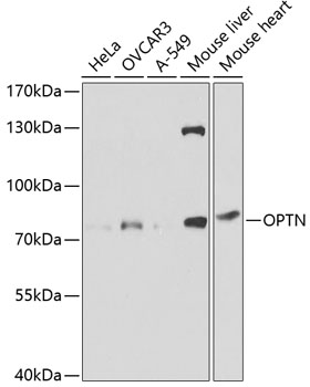 OPTN Rabbit polyclonal antibody