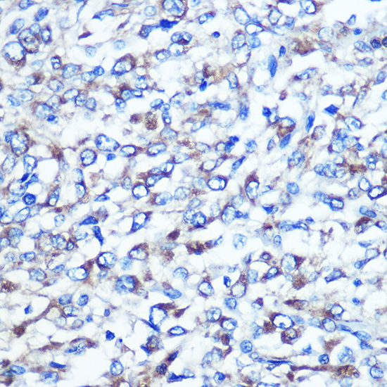 OPTN Rabbit polyclonal antibody