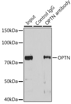 OPTN Rabbit polyclonal antibody