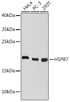 HSPB7 Rabbit polyclonal antibody