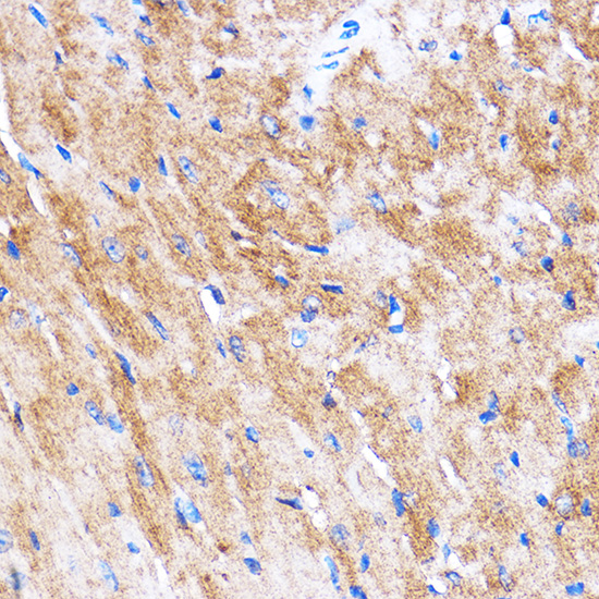 HSPB7 Rabbit polyclonal antibody