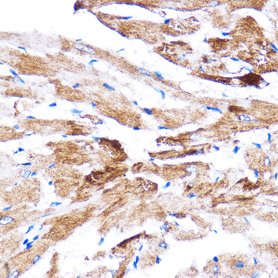 HSPB7 Rabbit polyclonal antibody