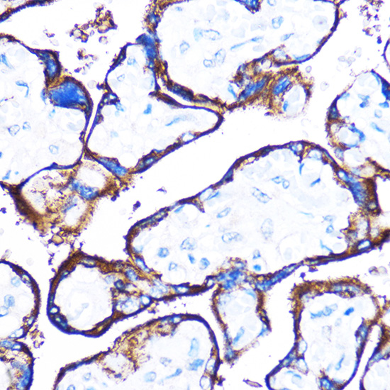 HSPB7 Rabbit polyclonal antibody