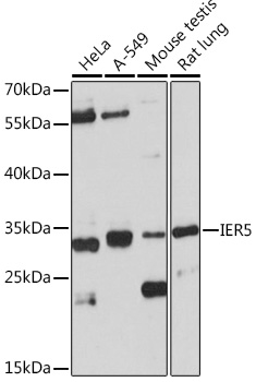 IER5 Rabbit polyclonal antibody