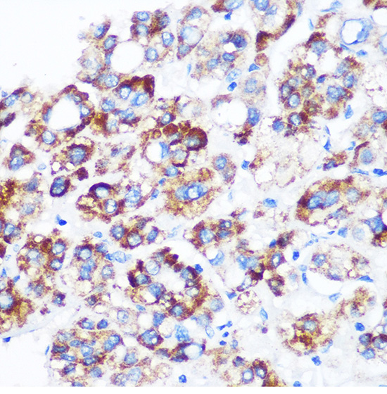 C9orf114 Rabbit polyclonal antibody