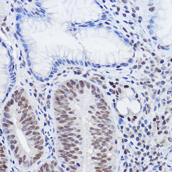 SIRT6 Rabbit polyclonal antibody