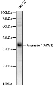 Arginase 1 (ARG1) Rabbit polyclonal antibody