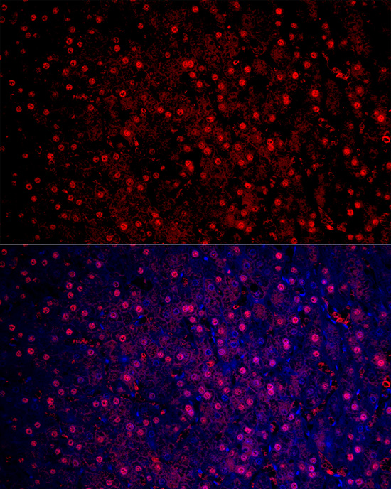 Arginase 1 (ARG1) Rabbit polyclonal antibody