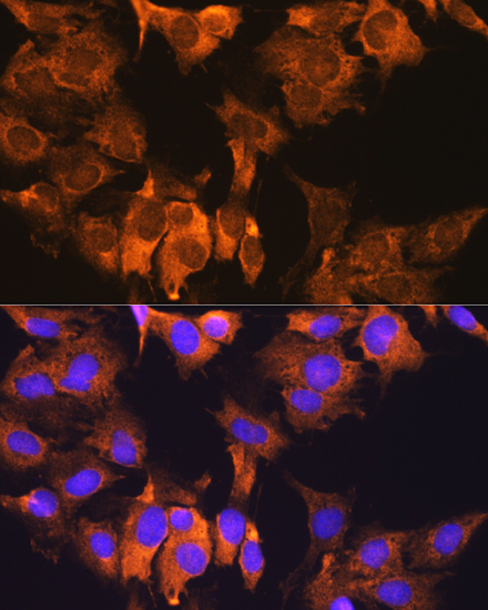 CDV3 Rabbit polyclonal antibody