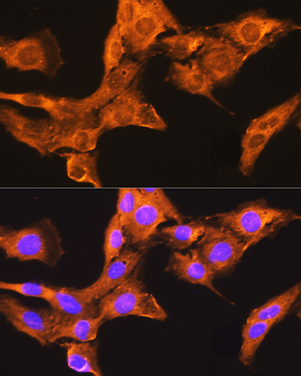 CDV3 Rabbit polyclonal antibody