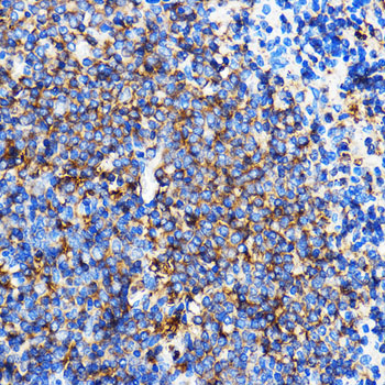 SERINC1 Rabbit polyclonal antibody
