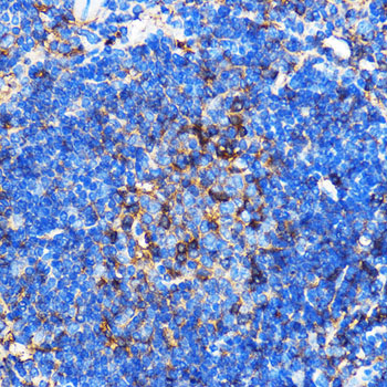 SERINC1 Rabbit polyclonal antibody