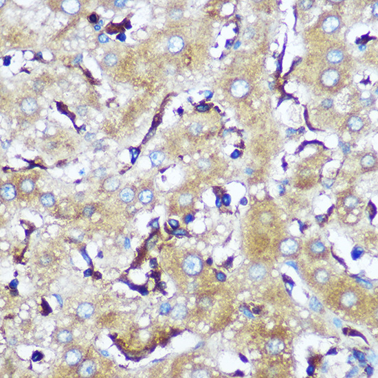 SERINC1 Rabbit polyclonal antibody