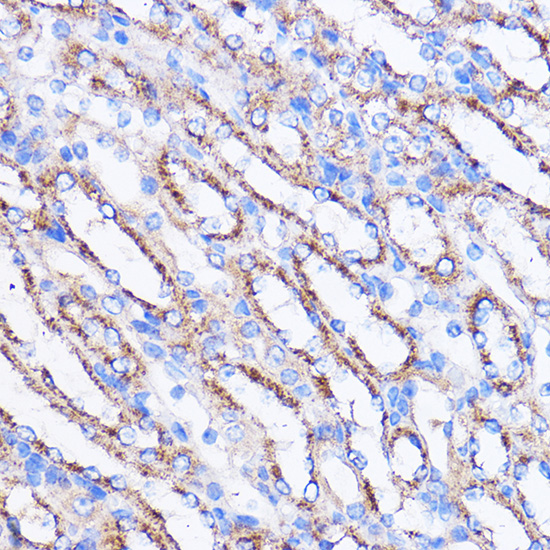 MIER1 Rabbit polyclonal antibody