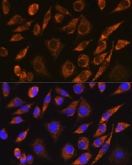 CELF5 Rabbit polyclonal antibody