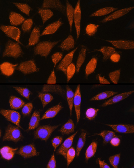 CHCHD7 Rabbit polyclonal antibody