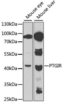 PTGIR Rabbit polyclonal antibody