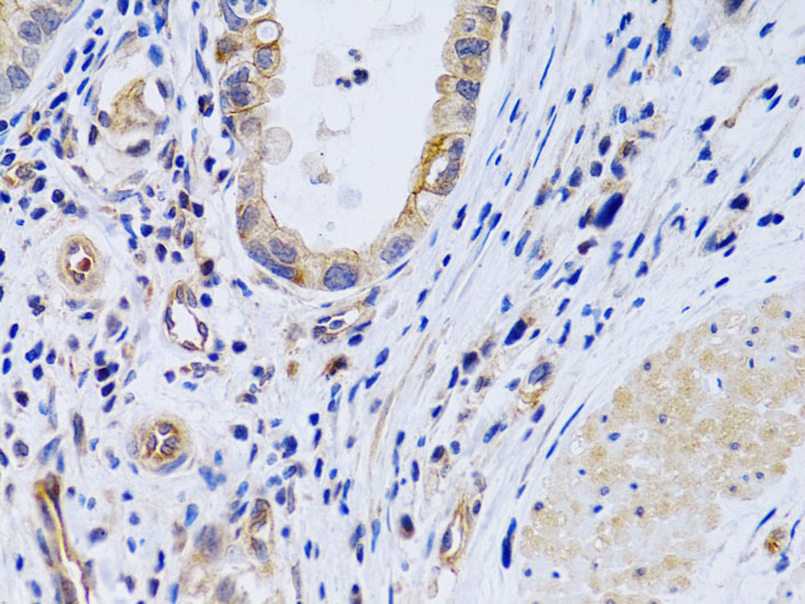 PTGIR Rabbit polyclonal antibody
