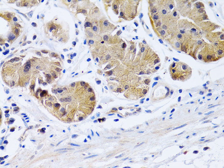 PTGIR Rabbit polyclonal antibody