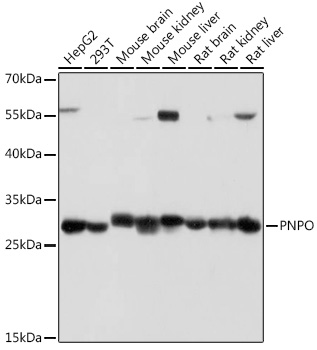 PNPO Rabbit polyclonal antibody