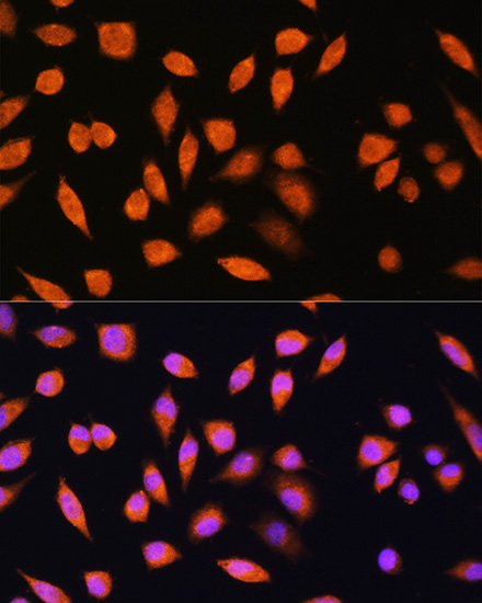 PNPO Rabbit polyclonal antibody
