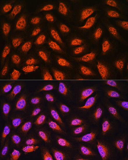 PNPO Rabbit polyclonal antibody