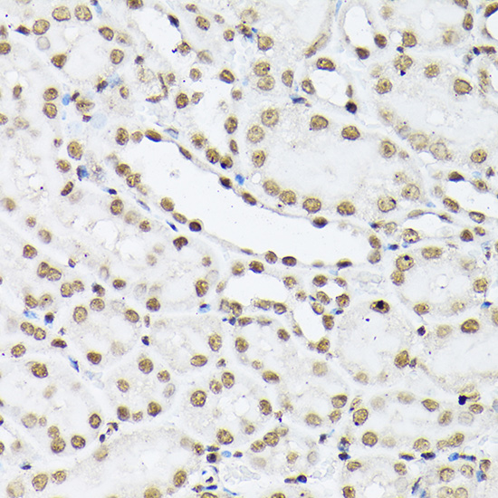 Histone H1t Rabbit polyclonal antibody