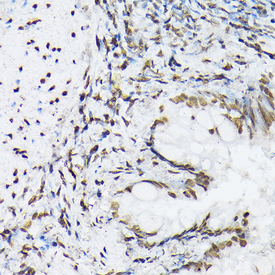 Histone H1t Rabbit polyclonal antibody