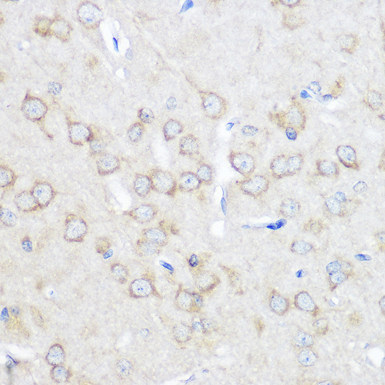 ADORA1 Rabbit polyclonal antibody