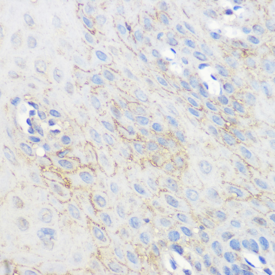 ADORA1 Rabbit polyclonal antibody