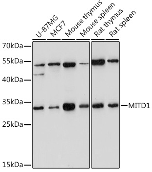 MITD1 Rabbit polyclonal antibody