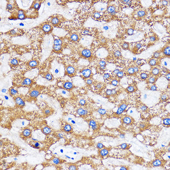 MITD1 Rabbit polyclonal antibody