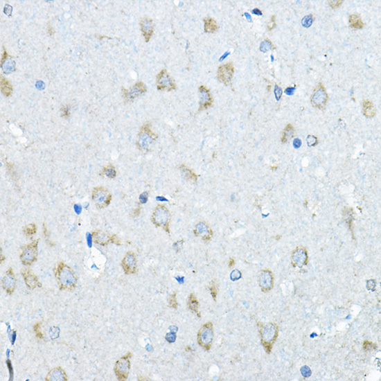 IDS Rabbit polyclonal antibody