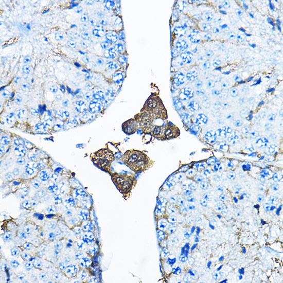 IDS Rabbit polyclonal antibody