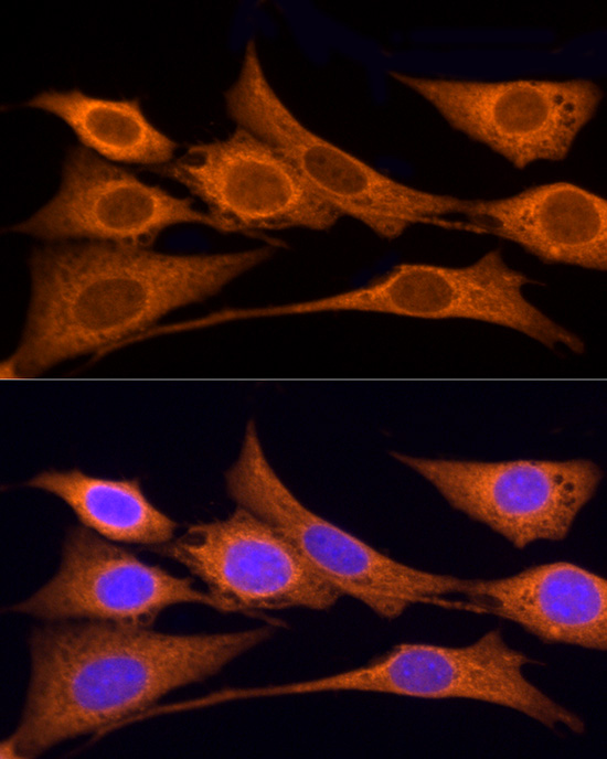 IDS Rabbit polyclonal antibody