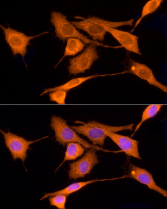 IDS Rabbit polyclonal antibody