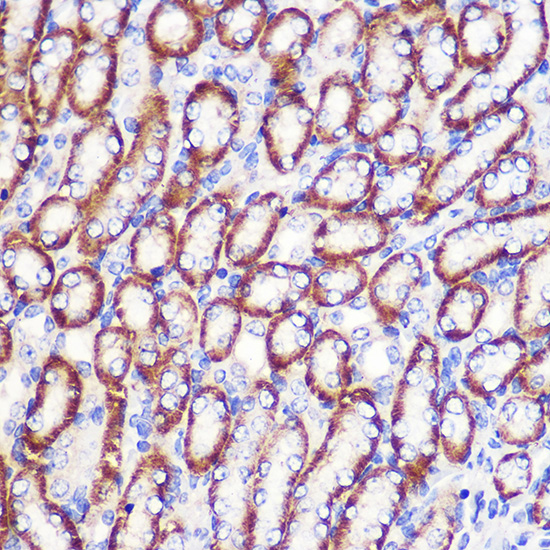 [KD Validated] LDHA Rabbit polyclonal antibody
