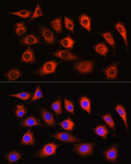 [KD Validated] LDHA Rabbit polyclonal antibody