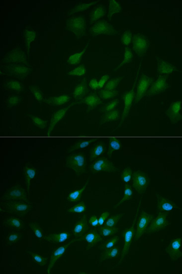 LIG1 Rabbit polyclonal antibody