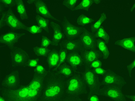 LIG1 Rabbit polyclonal antibody