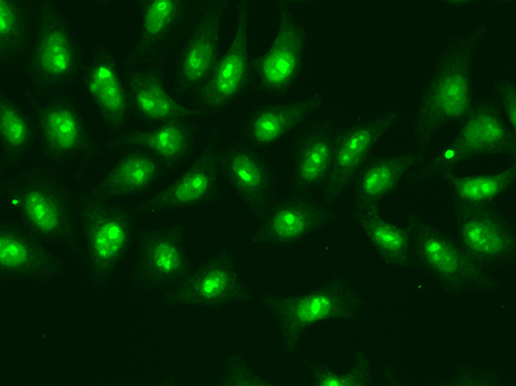POLR2D Rabbit polyclonal antibody