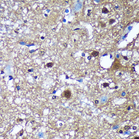 TSN Rabbit polyclonal antibody